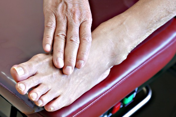 foot-problems-arthritis