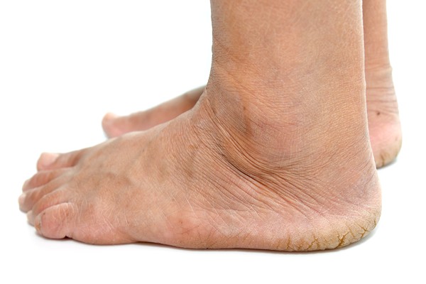 foot-problems-diabetes