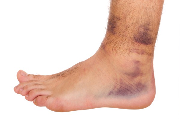 foot-problems-foot_ankle_injuries
